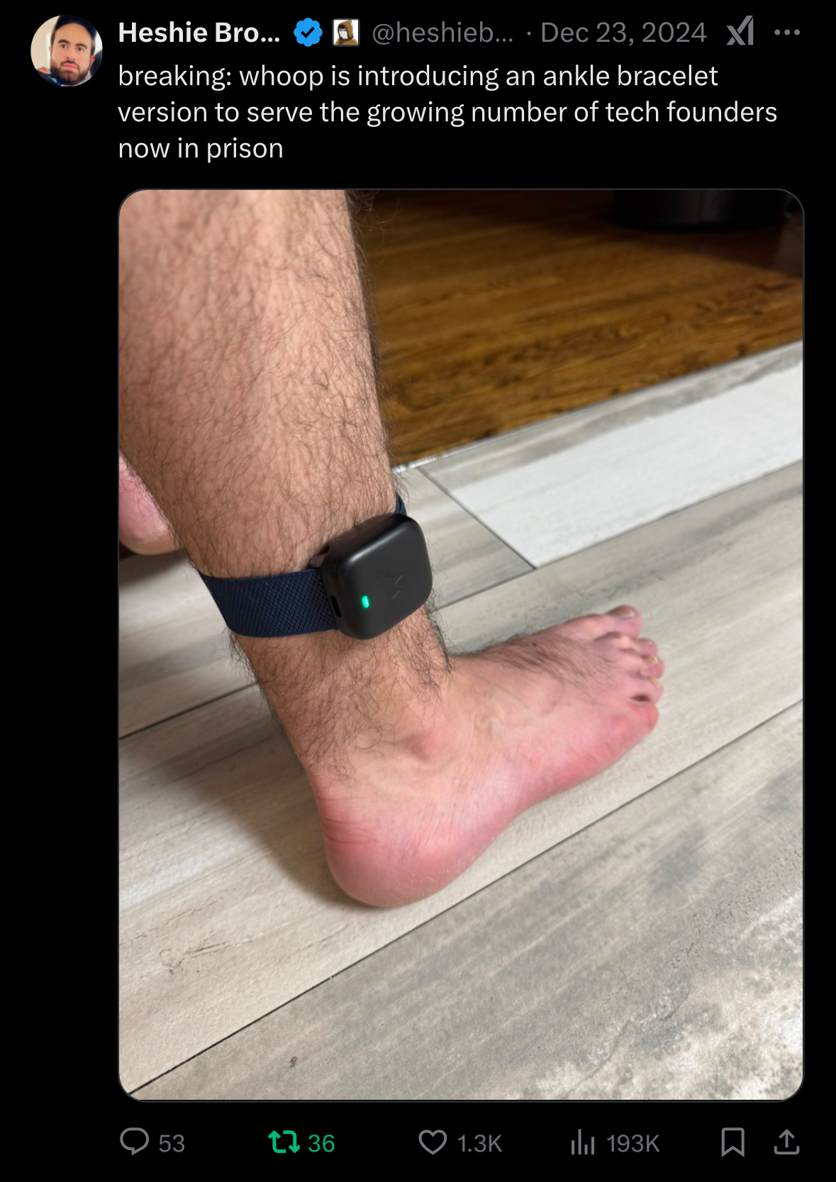 Whoop Ankle Bracelet